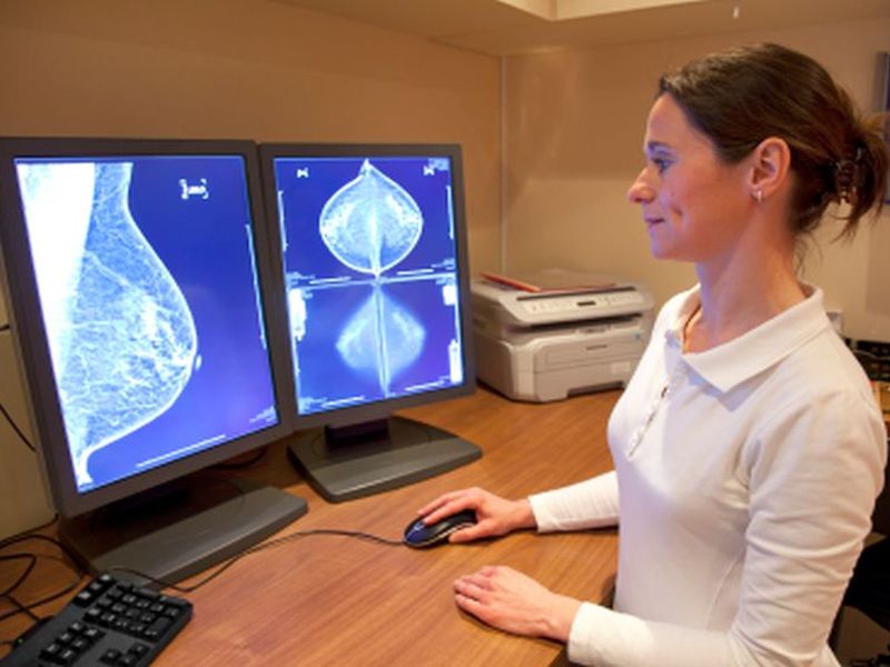 News Picture: Drug Halves Tumor Recurrence for Women With a Common Breast Cancer