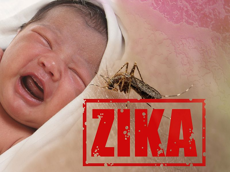 News Picture: Scans, Ultrasound Spot Zika Brain Defects