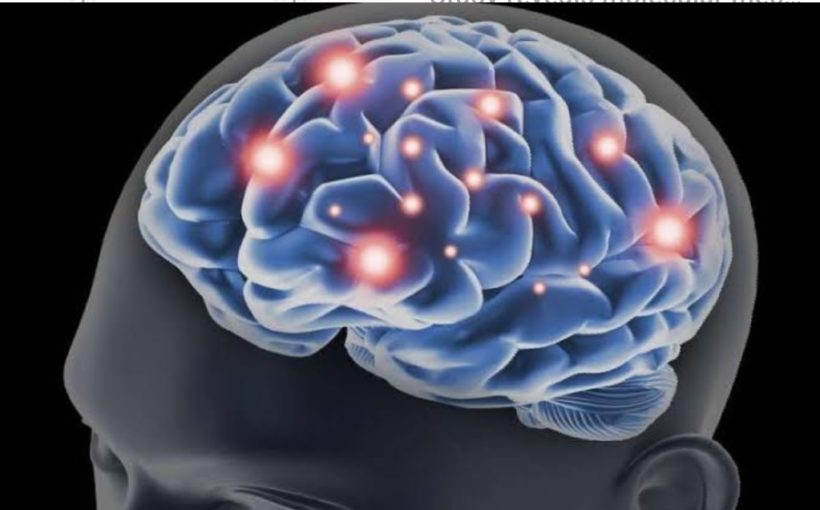 Study shows deep brain stimulation encouraging for stroke patients