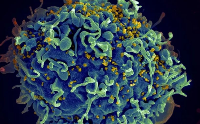 'Dormant' HIV produces RNA and proteins during anti-retroviral therapy