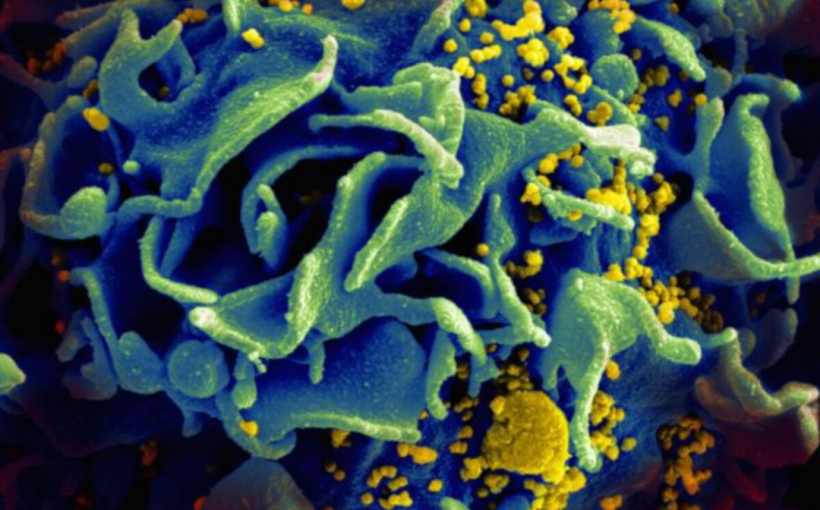 Could a cancer drug hold the key to an HIV cure?