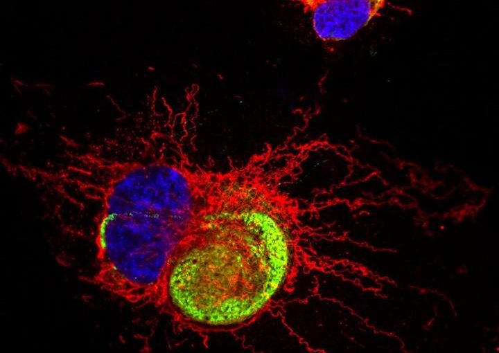 Consequences of Zika virus attack on glial cells