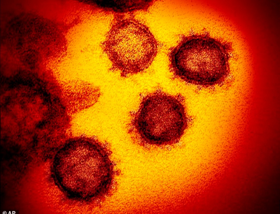 environmental-conditions-found-to-affect-stability-of-virus-that-causes