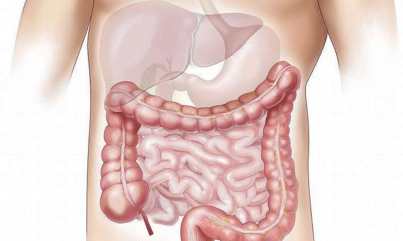 Nutrients drive cellular reprogramming in the intestine