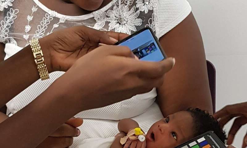 App detecting jaundice may prevent deaths in newborns