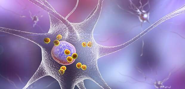 Parkinson's disease: Essential role in neuroinflammation found for a subset of brain macrophages