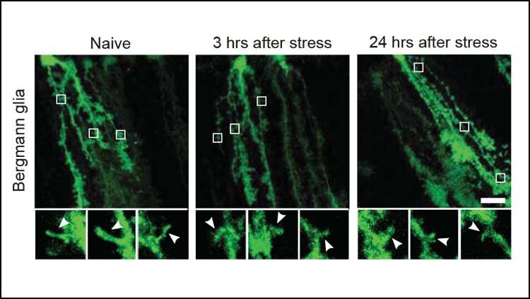 Research shows how stress remodels the brain