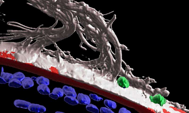 Eye injury sets immune cells on surveillance to protect the lens