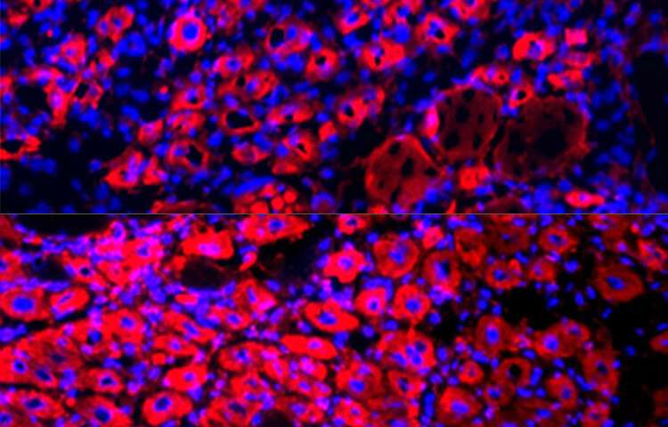 Diluting blood plasma rejuvenates tissue, reverses aging in mice
