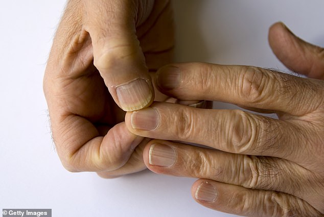 What your fingernails really say about your health