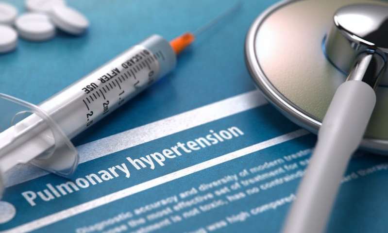 Pulmonary hypertension: Why creating awareness is key in Africa