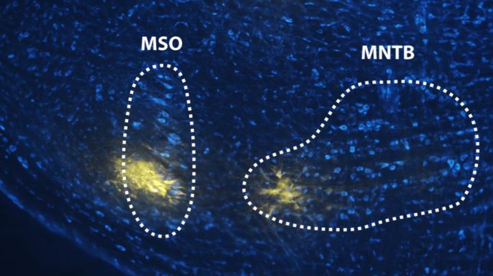 Study sheds new light on how the brain distinguishes speech from noise