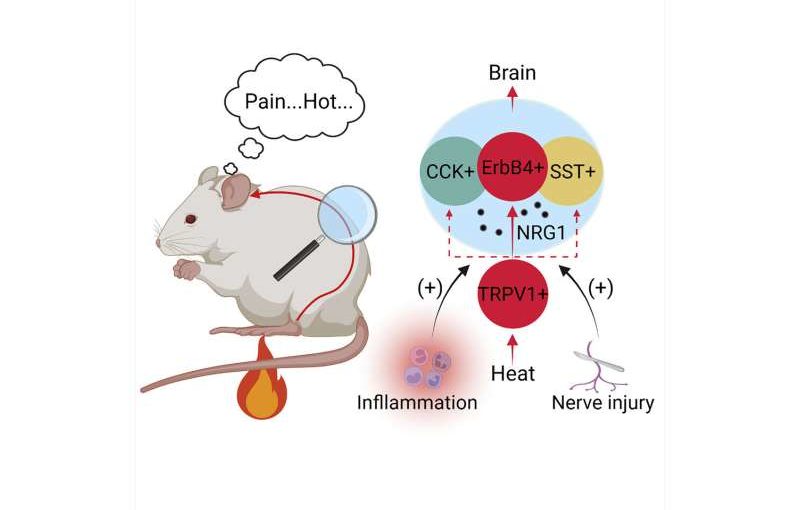How does the brain process heat as pain?